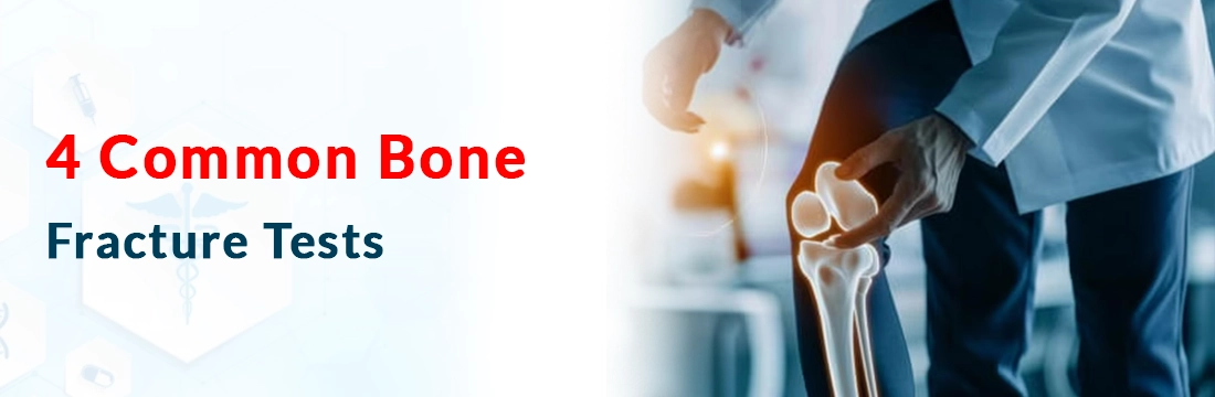  4 Common Bone Fracture Tests